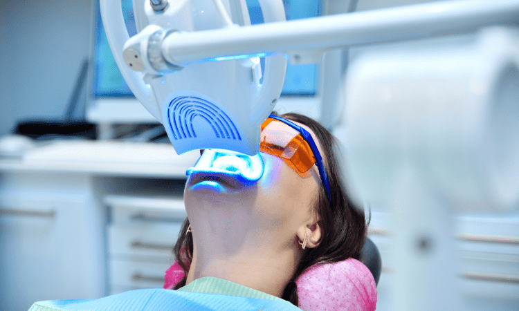While over-the-counter whitening kits promise results, they often fall short when compared to the outcomes of professional teeth whitening.